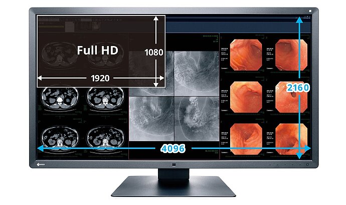 Monitor_Ideal_Teleradiologia_-_Image_05.jpg